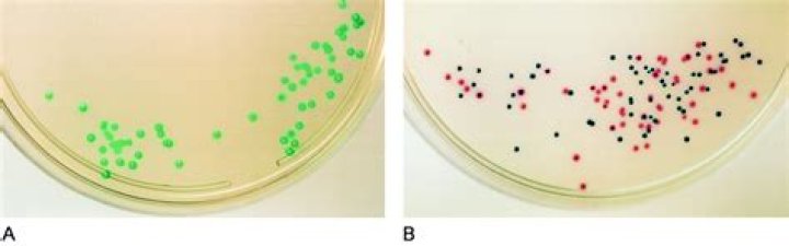 Evaluation of S-aureus ID, a new chromogenic agar medium for detection of Staphylococcus aureus - ePrints