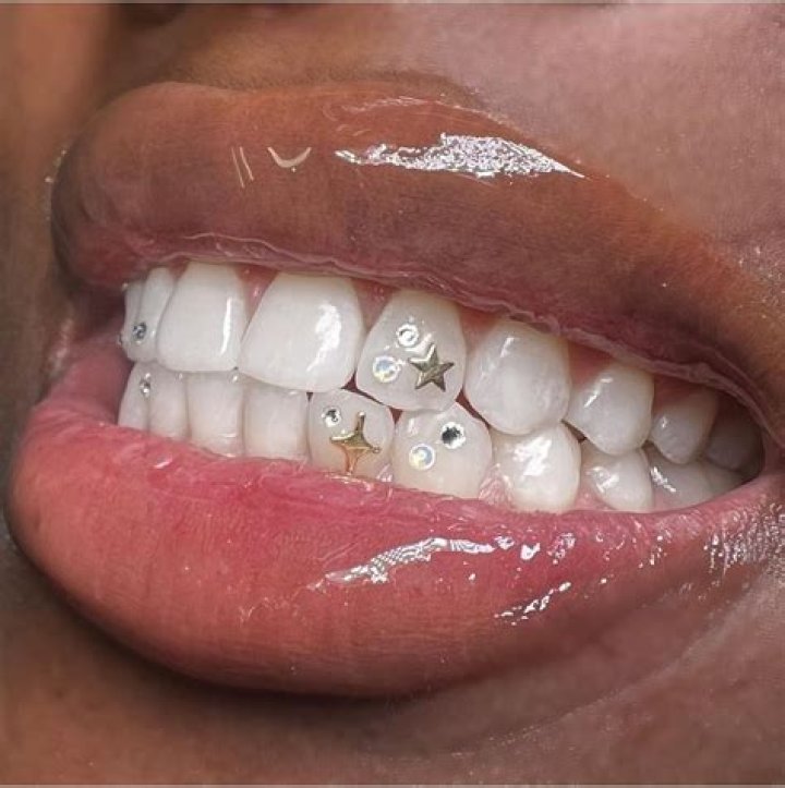 Tooth gems are back on the beauty agenda